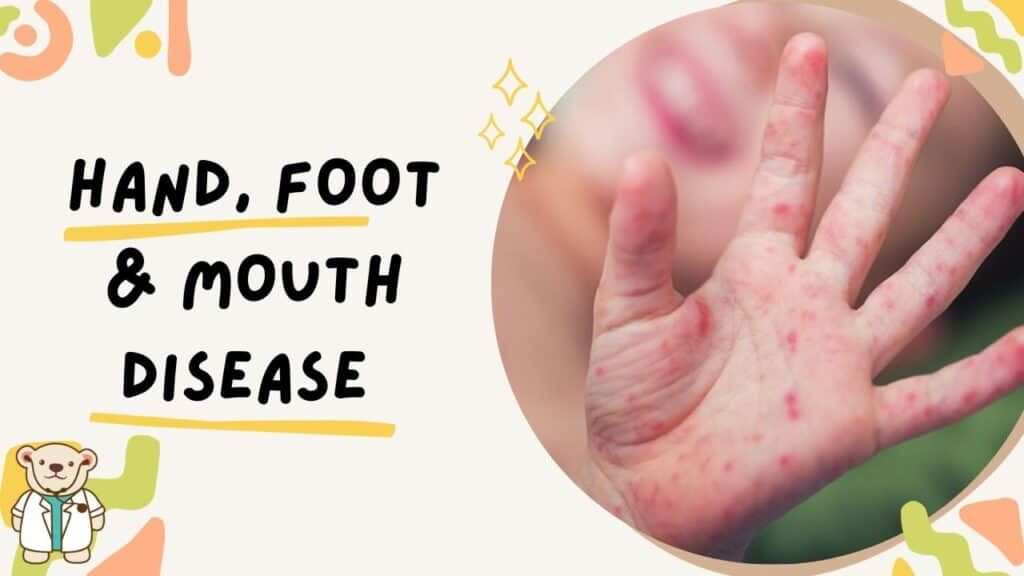Be Aware of Hand, Foot & Mouth